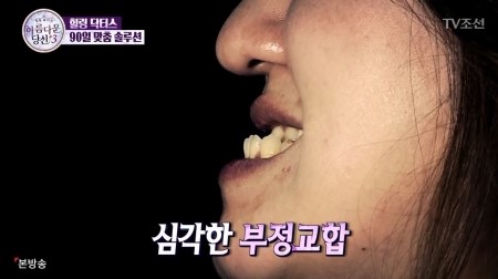 DA성형외과 X 아름다운당신3 방혜정 비하인드 관련 이미지 4