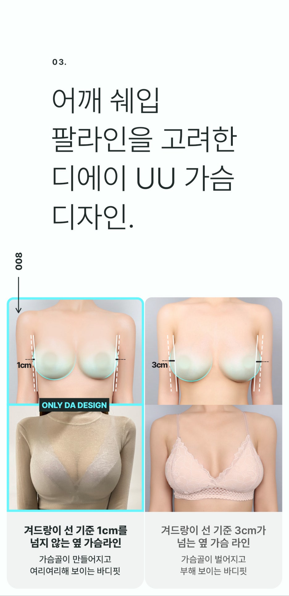 강남 가슴성형 잘 하는 곳 제대로 알아보려면 관련 이미지 6