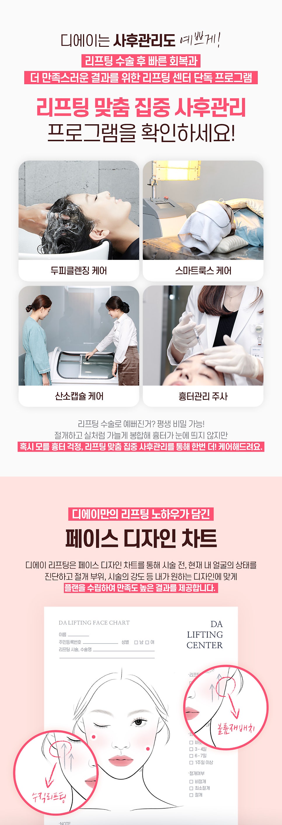 수직미니리프팅 수술법 가격 효과 알아보자면 관련 이미지 7