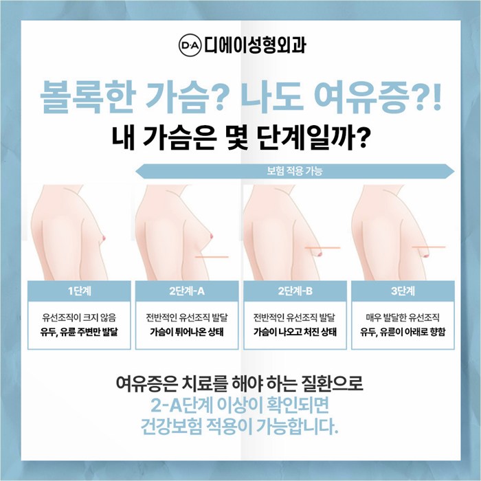 여성형유방증, 이런 경우 수술을 권장합니다. 관련 이미지 4