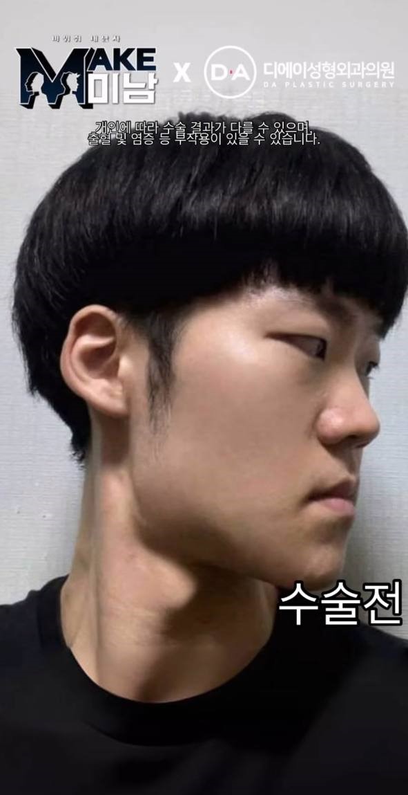 [맥미남] 소심이내남자 한 눈에 보는 외모변천사 관련 이미지 3