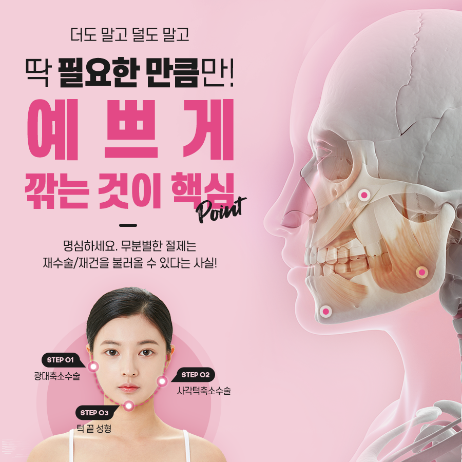 안면윤곽 수술 전 확인해야 하는 것은? 관련 이미지 4