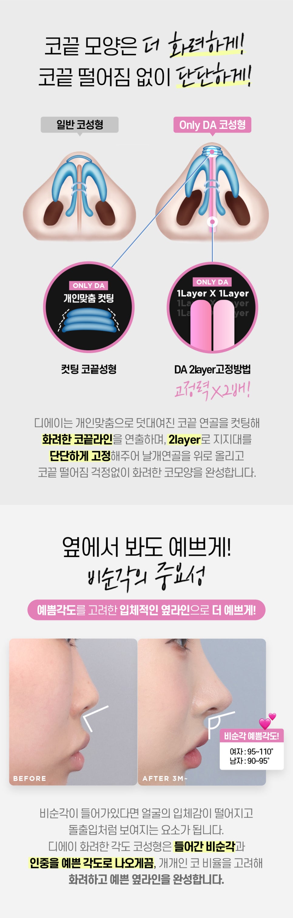 DA성형외과 | 코라인을 예쁘게 살리고 싶다면 관련 이미지 3