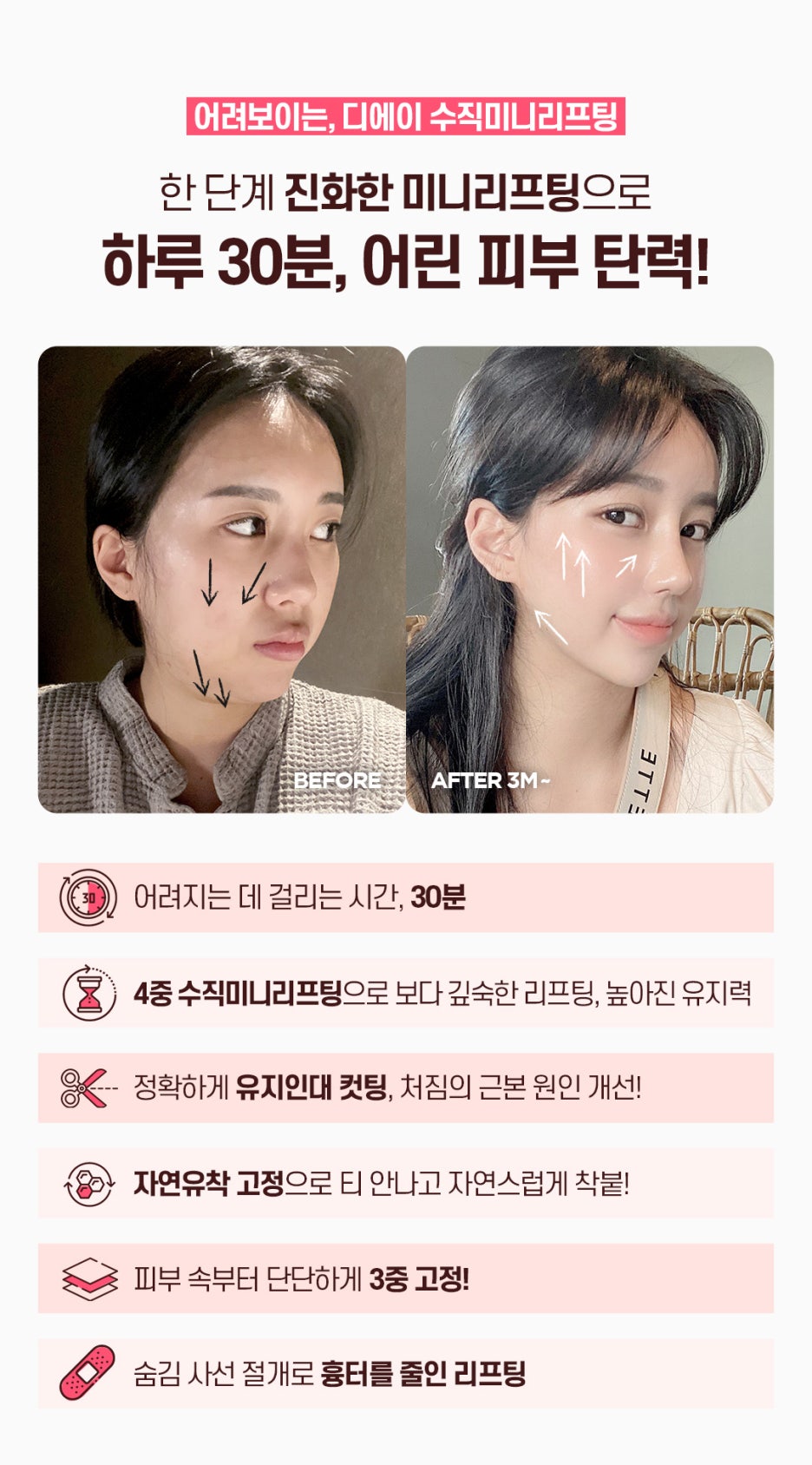 수직미니리프팅 수술법 가격 효과 알아보자면 관련 이미지 3