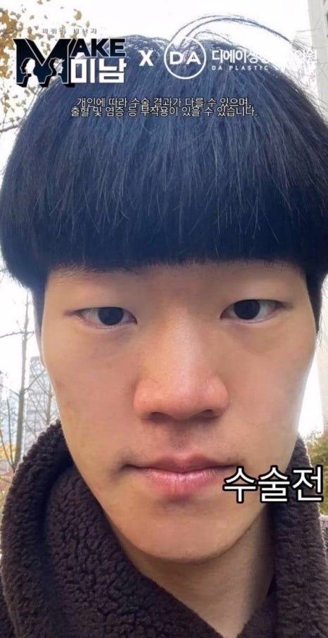 [맥미남] 소심이내남자 한 눈에 보는 외모변천사 관련 이미지 2