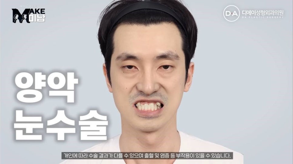 무엇이든물어보살 홍민기 성형 맥미남 후기 관련 이미지 2