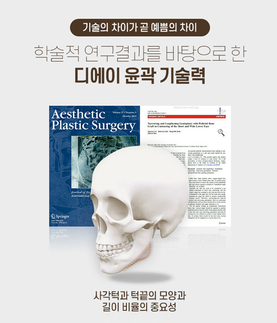 디에이 안면윤곽, 예쁘게 깎고 예쁘게 남기다 관련 이미지 8
