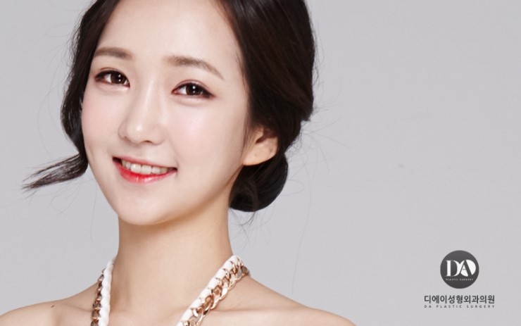 성공적인 눈성형, 관건은 눈형태에 따른 수술법 선택 관련 이미지 8