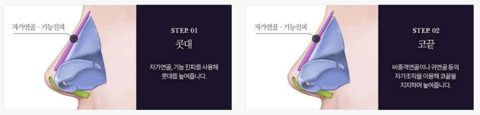자연스러운 남자성형을 원한다면 관련 이미지 12