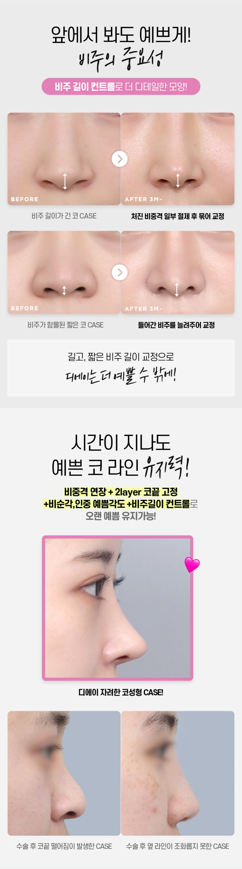 DA성형외과 | 코라인을 예쁘게 살리고 싶다면 관련 이미지 4