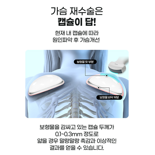 What Is the Best Plan for Breast Revision Surgery to Achieve the Highest Satisfaction? image 5