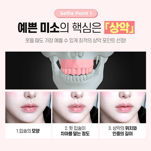 The End of Concerns About a Protruding Mouth &middot; Underbite? Key Information to Know Before Orthognathic Surgery image 4