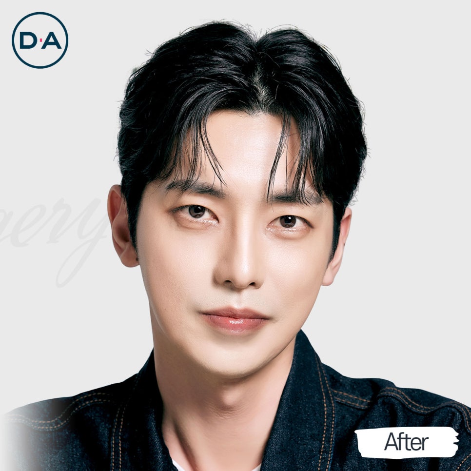 맥미남, 무엇이든물어보살 출연자는 무슨 성형 했을까? 관련 이미지 8