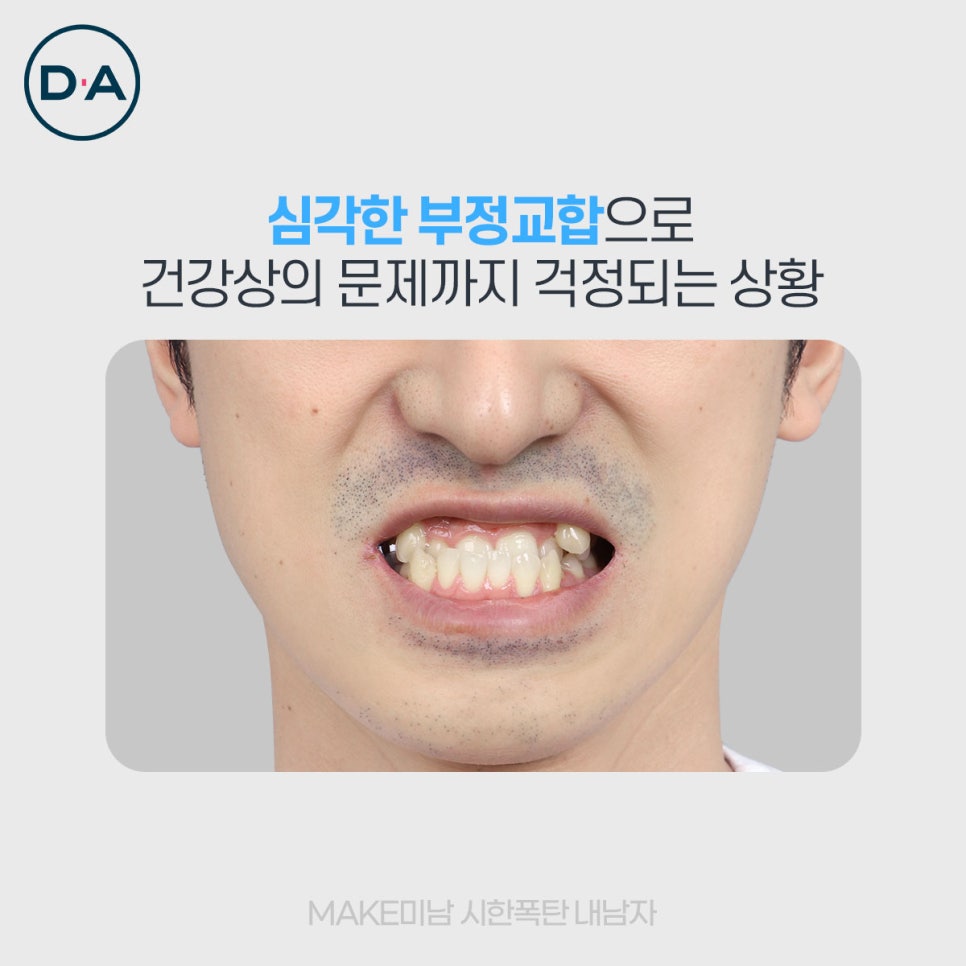 맥미남, 무엇이든물어보살 출연자는 무슨 성형 했을까? 관련 이미지 3