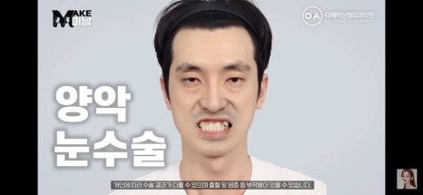 디에이성형외과 | 맥미남 시한폭탄내남자 개인인터뷰 근황 느낀점 관련 이미지 3