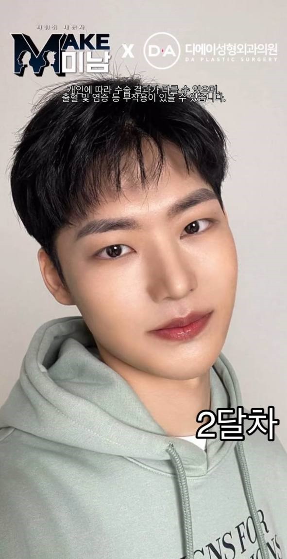 [맥미남] 소심이내남자 한 눈에 보는 외모변천사 관련 이미지 6