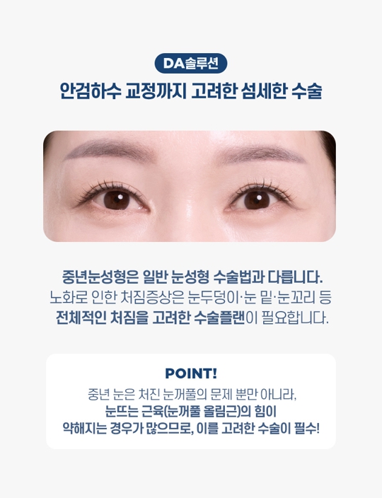 중년 눈성형, 처진 눈꺼풀의 원인에 따라 수술법이 달라집니다 관련 이미지 4
