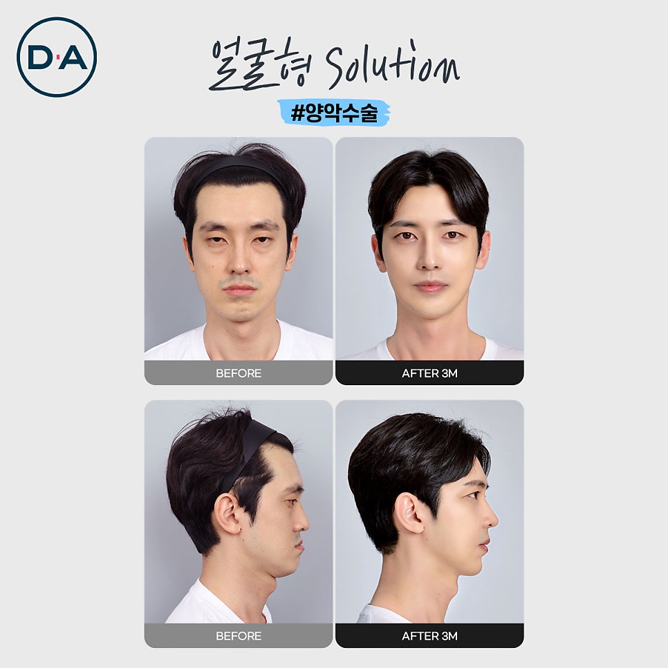맥미남, 무엇이든물어보살 출연자는 무슨 성형 했을까? 관련 이미지 6