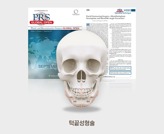 디에이 안면윤곽, 예쁘게 깎고 예쁘게 남기다 관련 이미지 9