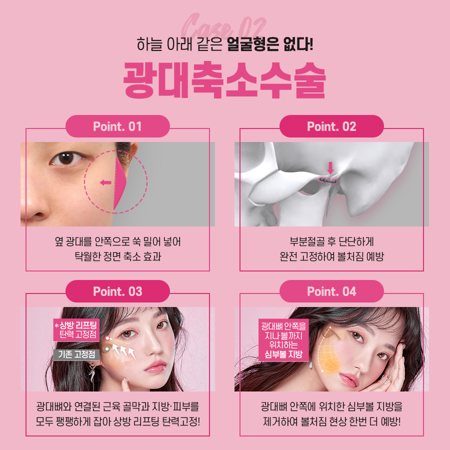 안면윤곽 수술 전 확인해야 하는 것은? 관련 이미지 7