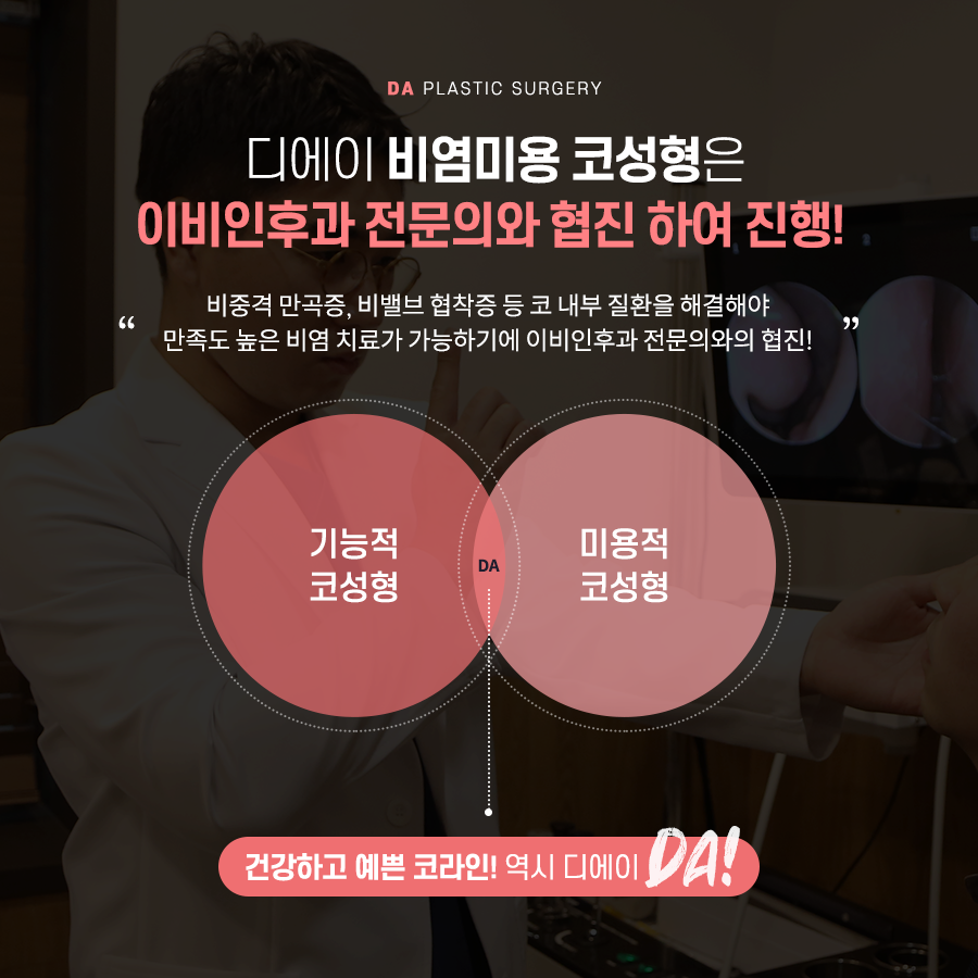 코성형, 개별 맞춤 수술을 위해 알아야 할 것 관련 이미지 8