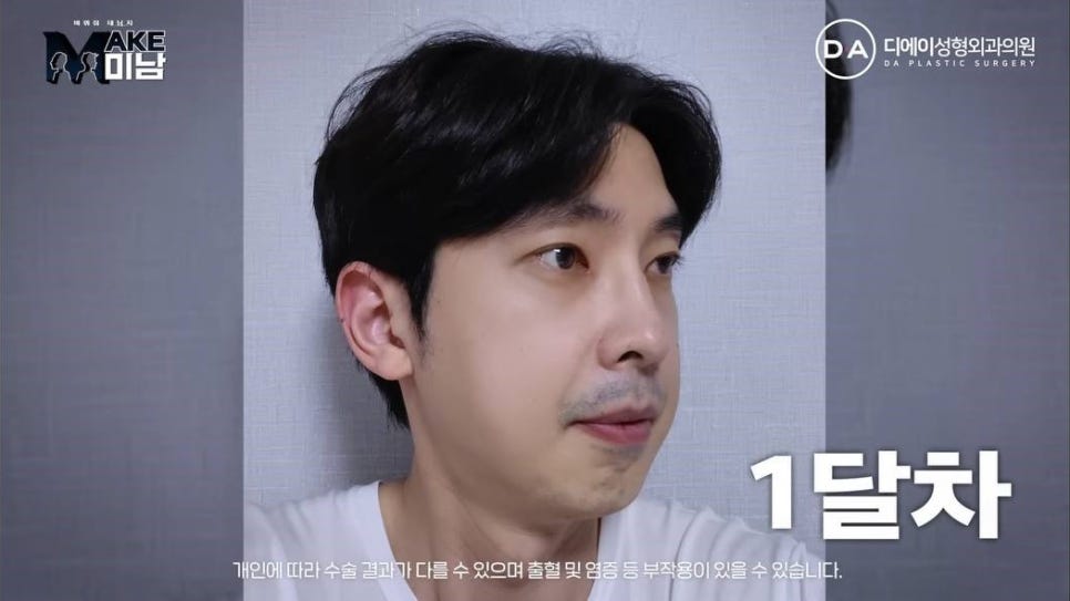 무엇이든물어보살 홍민기 성형 맥미남 후기 관련 이미지 9
