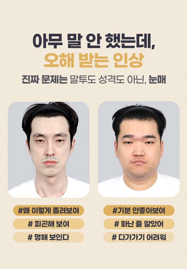 남자눈매교정, 자연스러운 남자눈성형을 위한 수술 방법과 고려사항 관련 이미지 2
