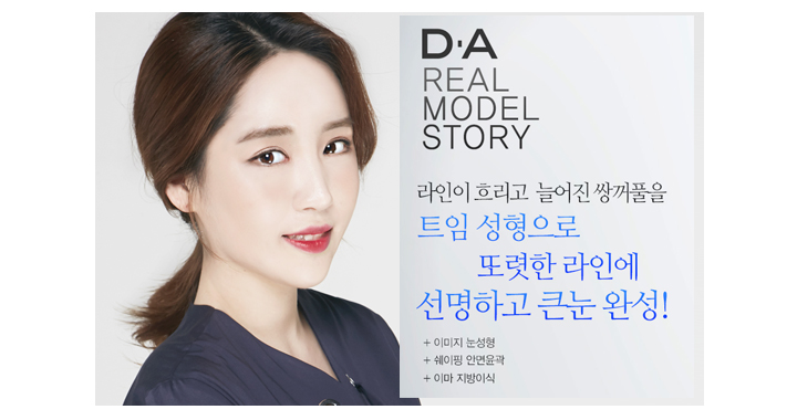 콤플렉스제로 트임성형 끝판왕 강지은 관련 이미지 8