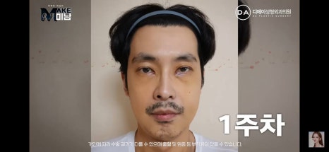 디에이성형외과 | 맥미남 시한폭탄내남자 개인인터뷰 근황 느낀점 관련 이미지 22