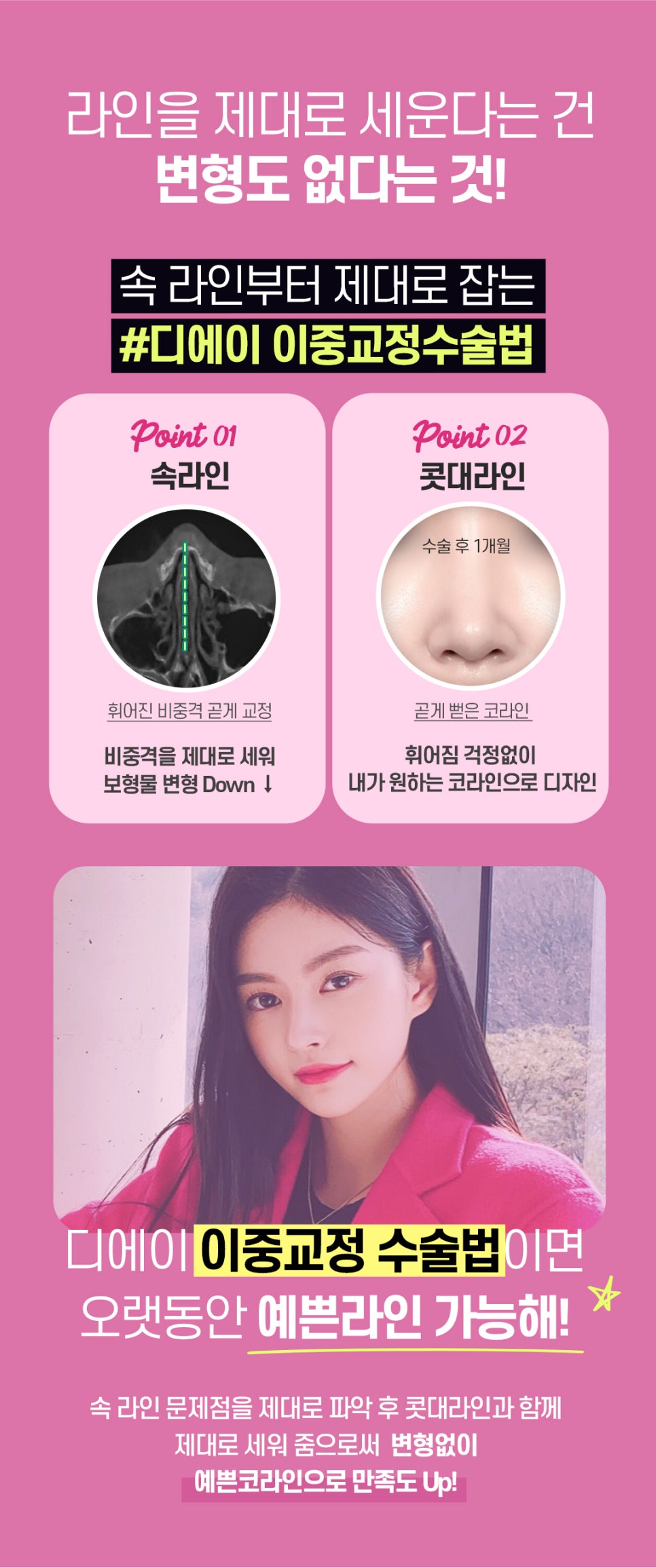 비염미용코성형 안전하고 확실하게 관련 이미지 3