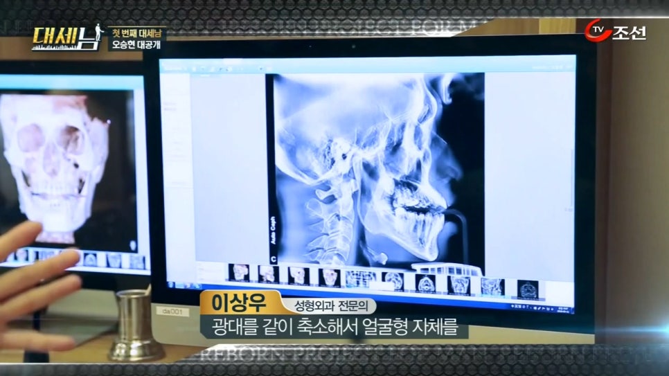 대세남 프랑켄슈타인 안면비대칭 오승현 관련 이미지 8
