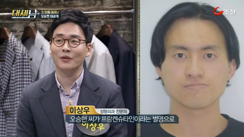 대세남 프랑켄슈타인 안면비대칭 오승현 관련 이미지 5