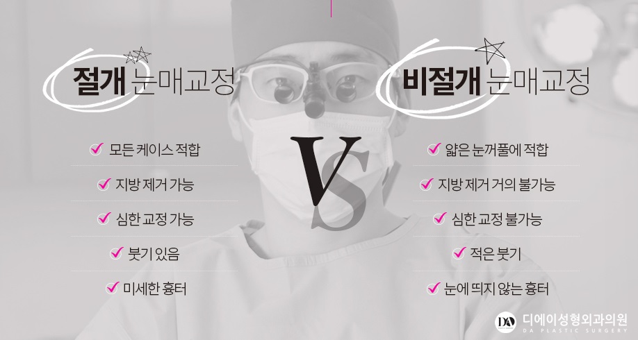 내 눈에 꼭 맞는 수술법은 무엇? 관련 이미지 9