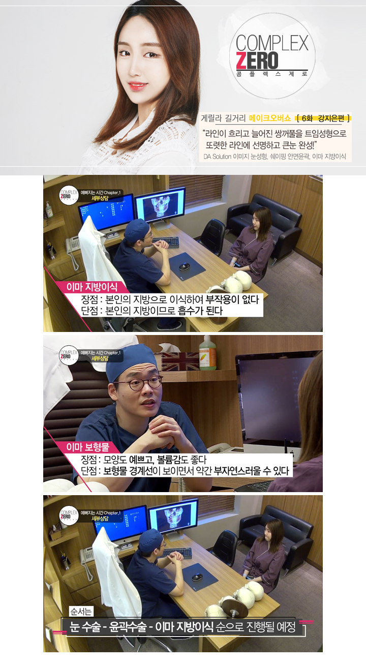 콤플렉스제로 트임성형 끝판왕 강지은 관련 이미지 5