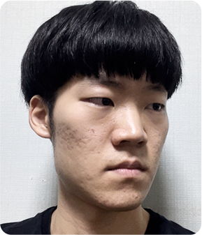 맥미남 | 소심남에서 훈남으로 - 디에이성형외과 방송출연 관련 이미지 2
