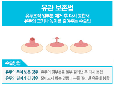 디에이 엄마를 부탁해 1. 가슴솔루션 관련 이미지 4