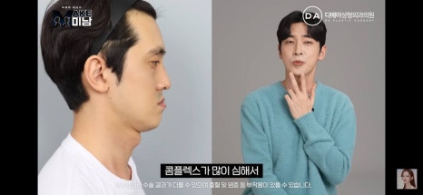 디에이성형외과 | 맥미남 시한폭탄내남자 개인인터뷰 근황 느낀점 관련 이미지 54