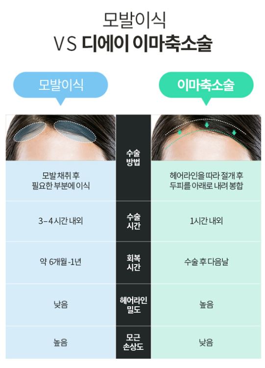 디에이성형외과 이마축소술, 작아보이는 얼굴 효과! 관련 이미지 5