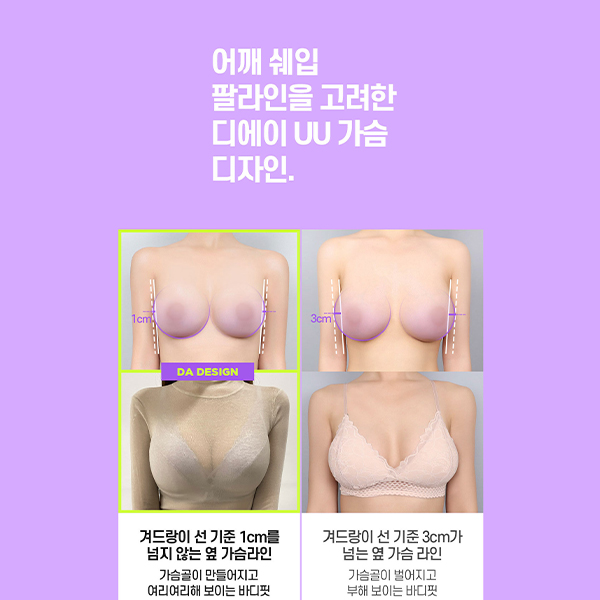A Complete Guide to Lift Breast Surgery for Improving Breast Sagging image 8