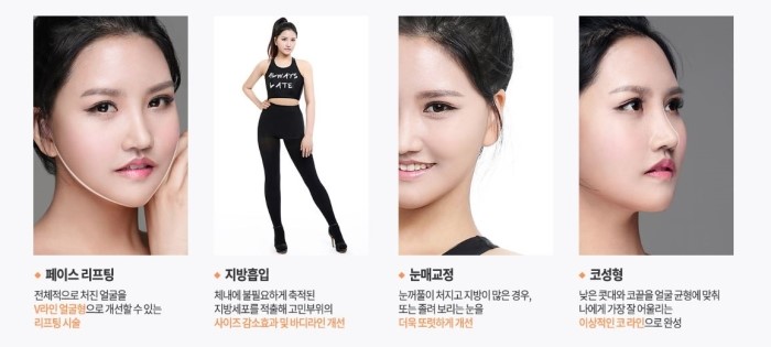아름다운당신 시즌3 X 디에이성형외과가 함께 한 첫번째 주인공, 김단아 편 관련 이미지 4