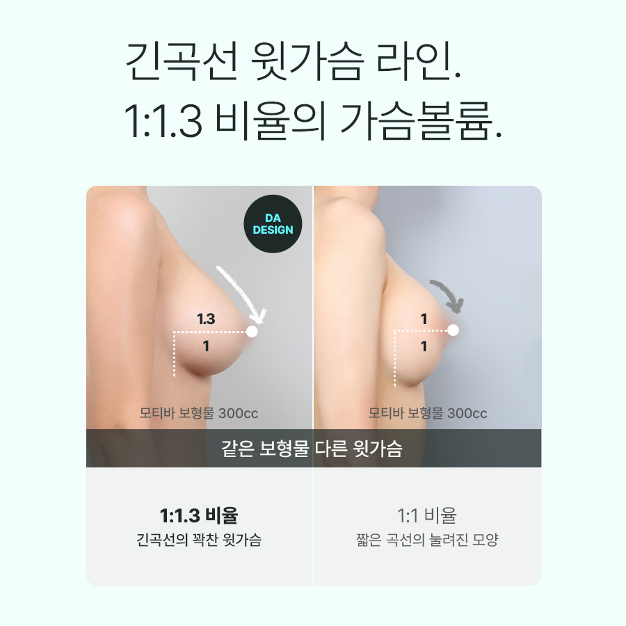 나에게 맞는 가슴성형, 체크 리스트 관련 이미지 4