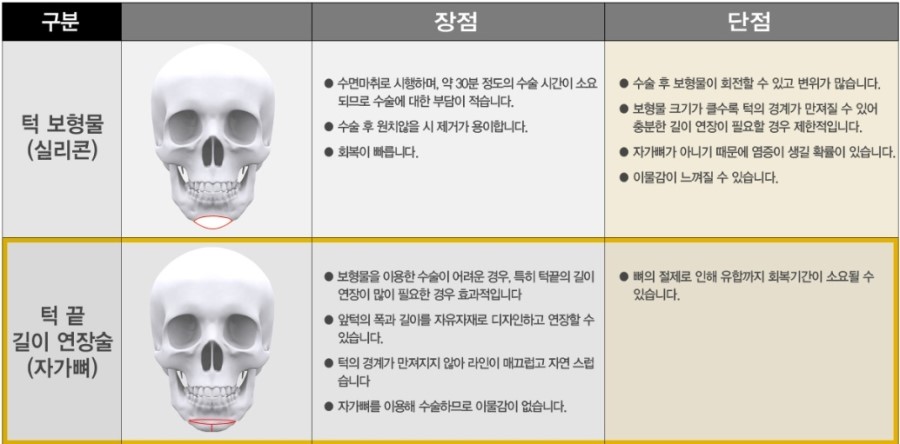 얼굴비율 바꾸는 턱끝길이연장 관련 이미지 4