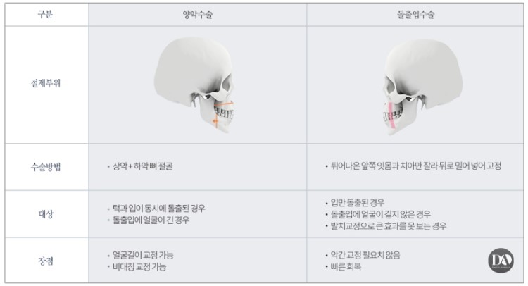 얼굴 유형에 따른 양악수술 솔루션 관련 이미지 15