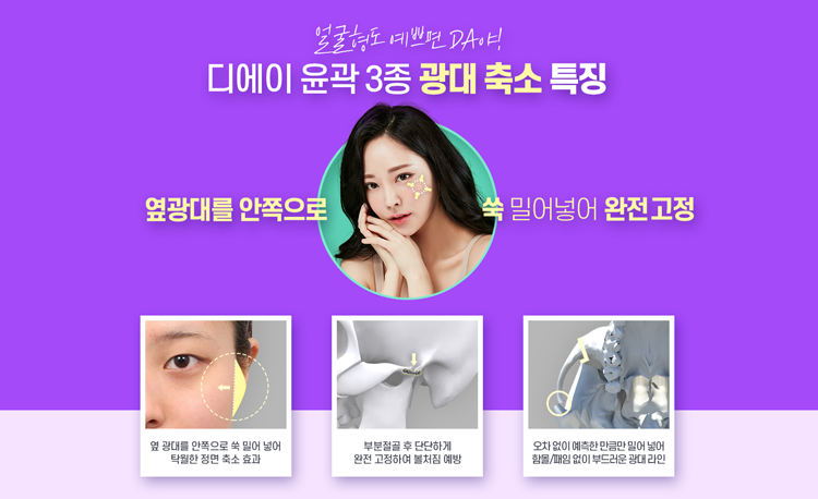 디에이성형외과, 윤곽3종으로 예쁨 UP 관련 이미지 7