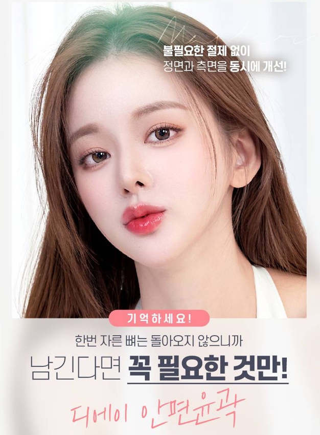 사각턱수술 비용보다 중요한 선택 기준은? 관련 이미지 7
