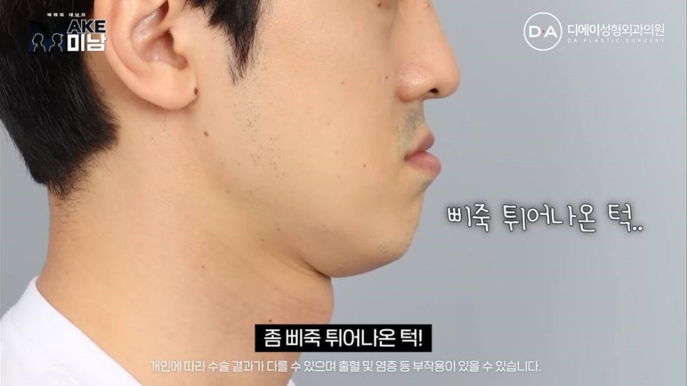 무엇이든물어보살 홍민기 성형 맥미남 후기 관련 이미지 3