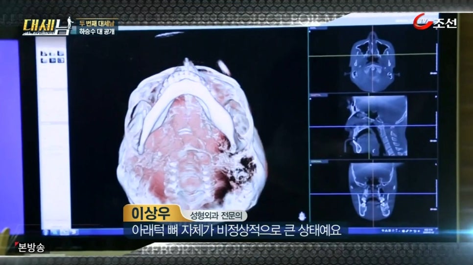 대세남 노인 흙수저 하승수 편 관련 이미지 19
