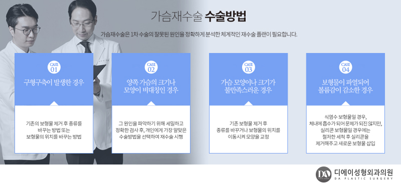 실패없는 가슴재수술 A~Z 관련 이미지 6