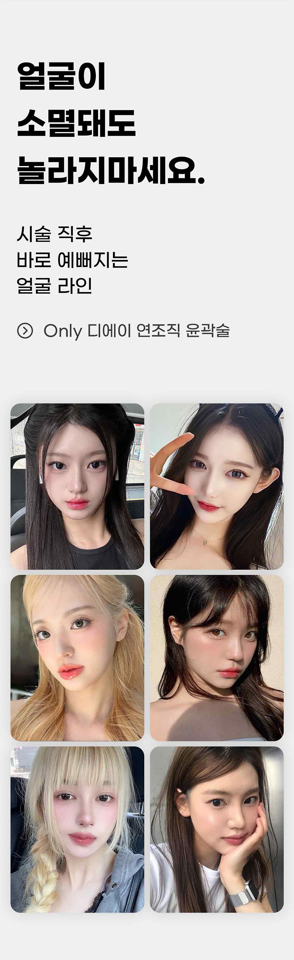 뼈깎기 대신 디에이 연조직윤곽술 관련 이미지 6