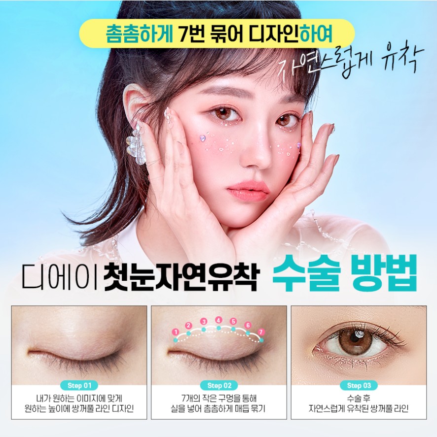 이미지에 맞게 라인 조절이 가능한 눈성형은? 관련 이미지 7